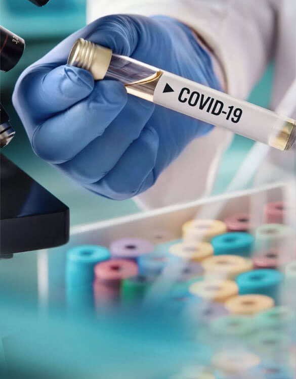 Osmolality testing in COVID-19